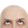 BaldGamers