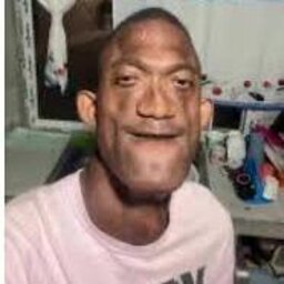 Sharten