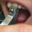 HTooTH#