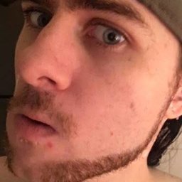 sh0xicwaste